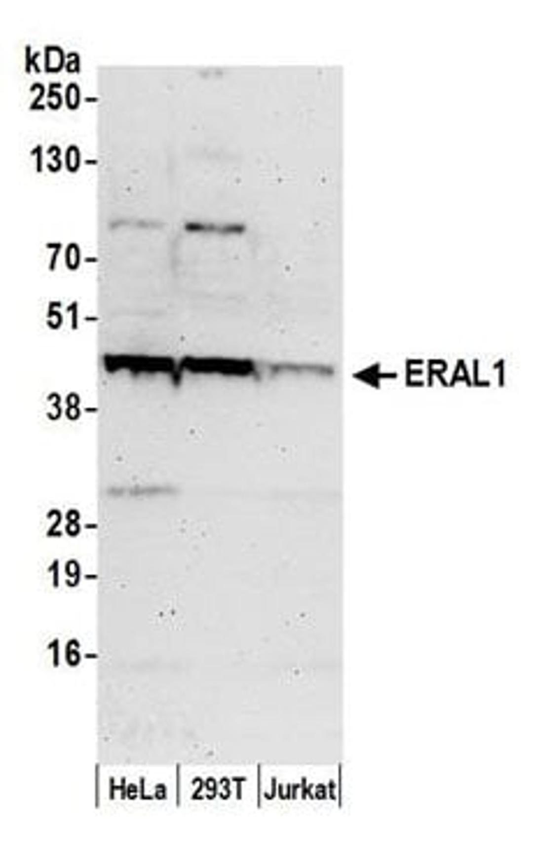 Detection of human ERAL1 by western blot.