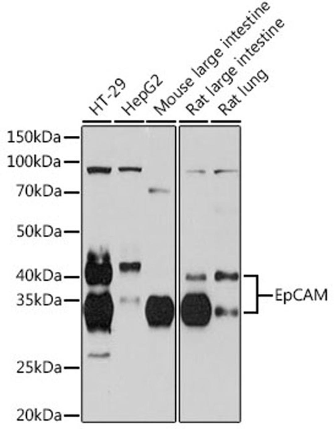 Western blot - EpCAM Rabbit mAb (A19301)