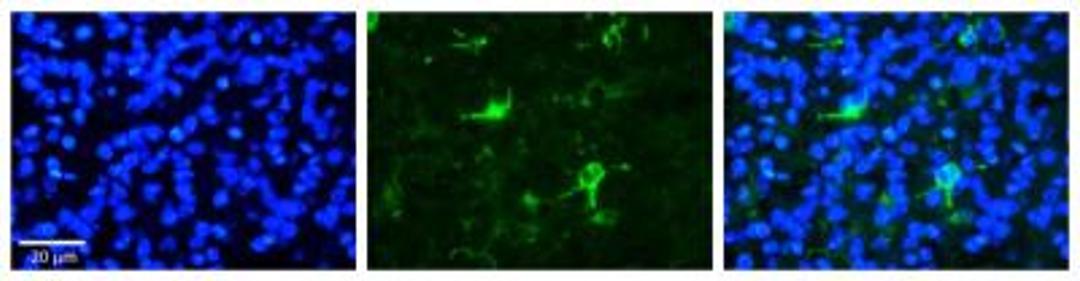 Immunocytochemistry: FBXW7/Cdc4 Antibody [NBP1-59631] - Formalin Fixed Paraffin; Embedded Tissue: Human Pineal Tissue; Observed Staining: Cytoplasmic in cell bodies and processes of pinealocytes; Primary Antibody Concentration: 1:100