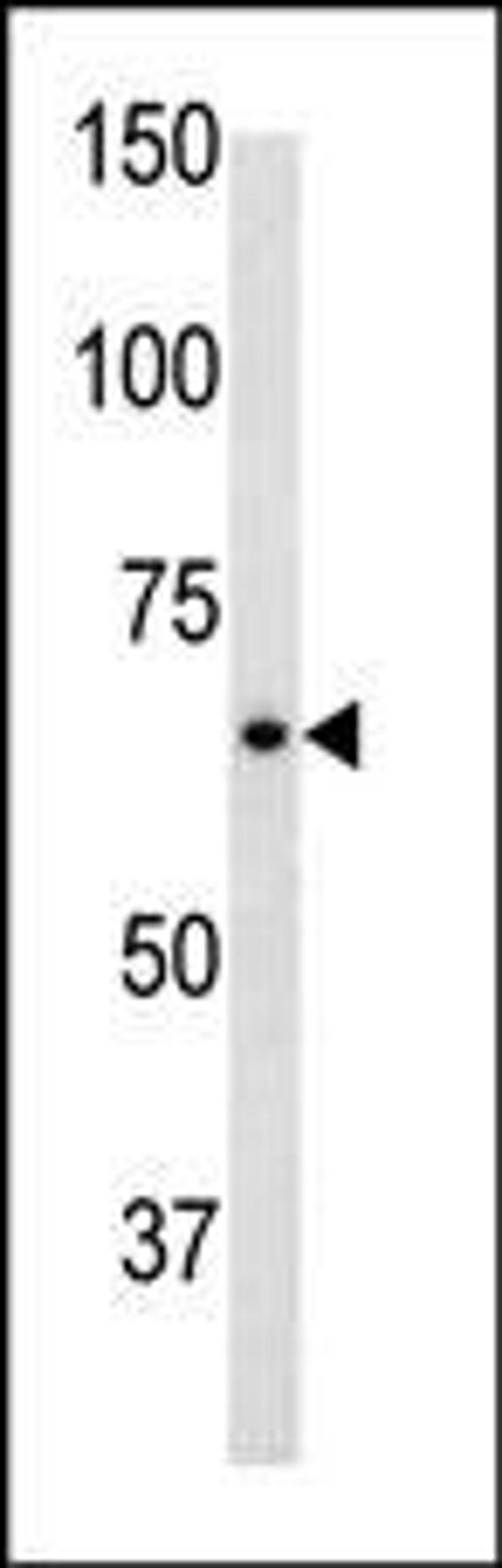 Antibody is used in Western blot to detect GFAP in mouse brain tissue lysate.