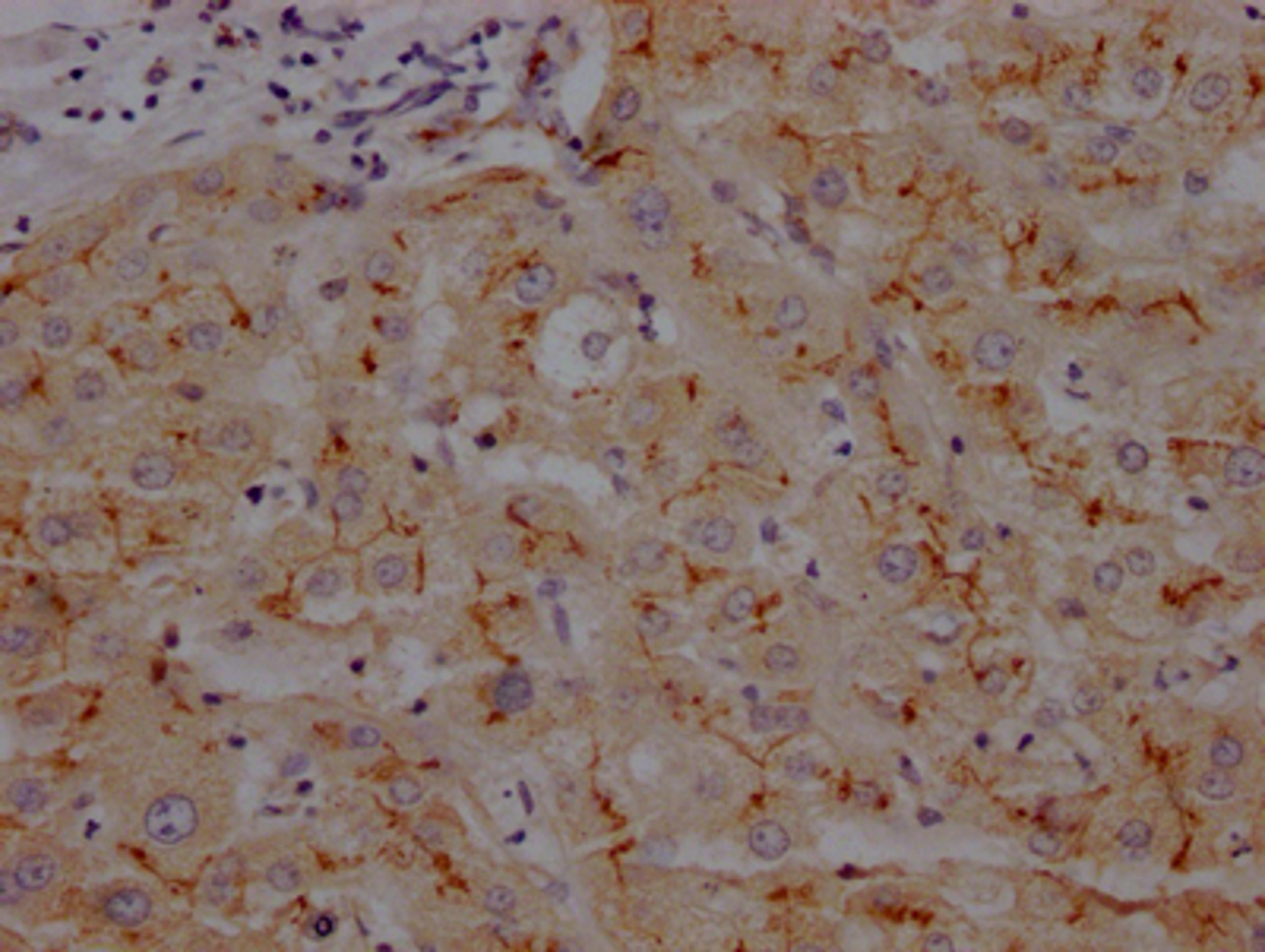 IHC image of CSB-RA993633A0HU diluted at 1:100 and staining in paraffin-embedded human liver tissue performed on a Leica BondTM system. After dewaxing and hydration, antigen retrieval was mediated by high pressure in a citrate buffer (pH 6.0). Section was blocked with 10% normal goat serum 30min at RT. Then primary antibody (1% BSA) was incubated at 4℃ overnight. The primary is detected by a Goat anti-rabbit IgG polymer labeled by HRP and visualized using 0.05% DAB.
