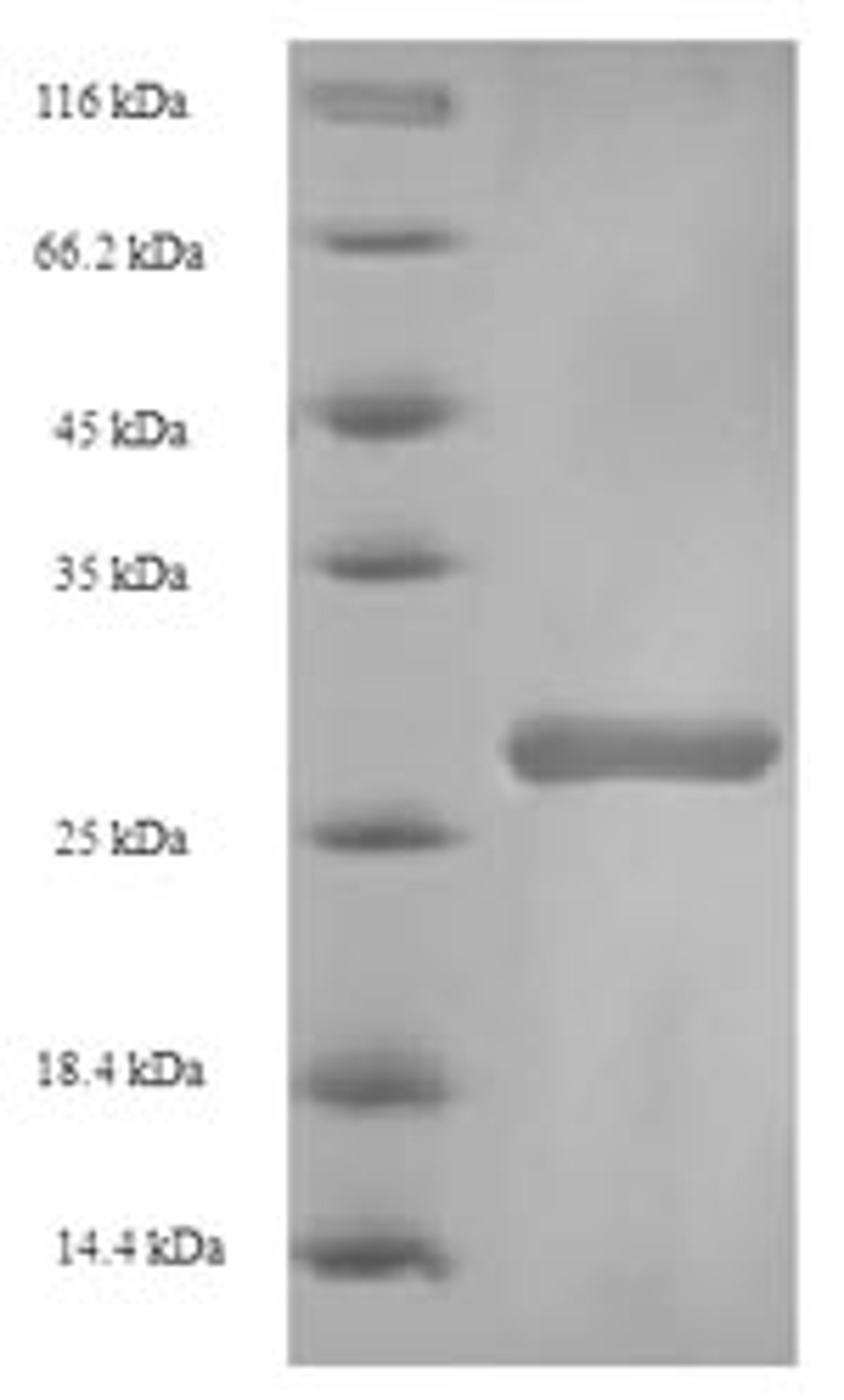 (Tris-Glycine gel) Discontinuous SDS-PAGE (reduced) with 5% enrichment gel and 15% separation gel.