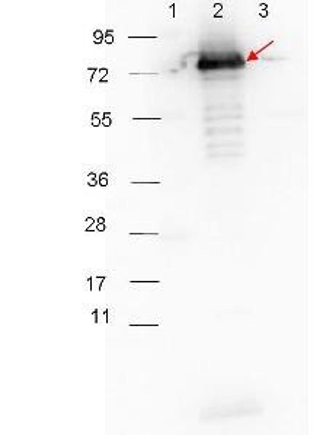 Western blot analysis of Lane 1: Molecular weight markers. Lane 2: MBP-p27 fusion protein (arrow; expected MW: 73.3 kDa). Lane 3: MBP alone using Surface Lipoprotein p27 antibody