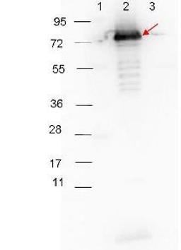 Western blot analysis of Lane 1: Molecular weight markers. Lane 2: MBP-p27 fusion protein (arrow; expected MW: 73.3 kDa). Lane 3: MBP alone using Surface Lipoprotein p27 antibody