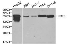 Western blot analysis of HepG2,293T,MCF-7,hela,DU145 cell line lysates using KRT8 antibody