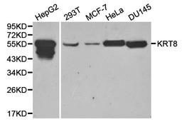 Western blot analysis of HepG2,293T,MCF-7,hela,DU145 cell line lysates using KRT8 antibody