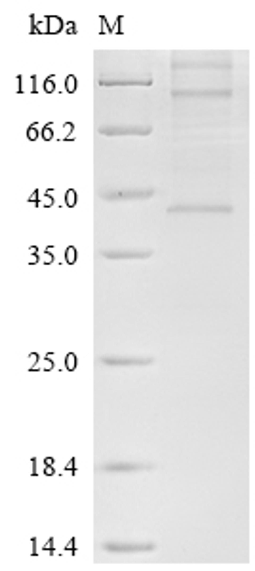 (Tris-Glycine gel) Discontinuous SDS-PAGE (reduced) with 5% enrichment gel and 15% separation gel.