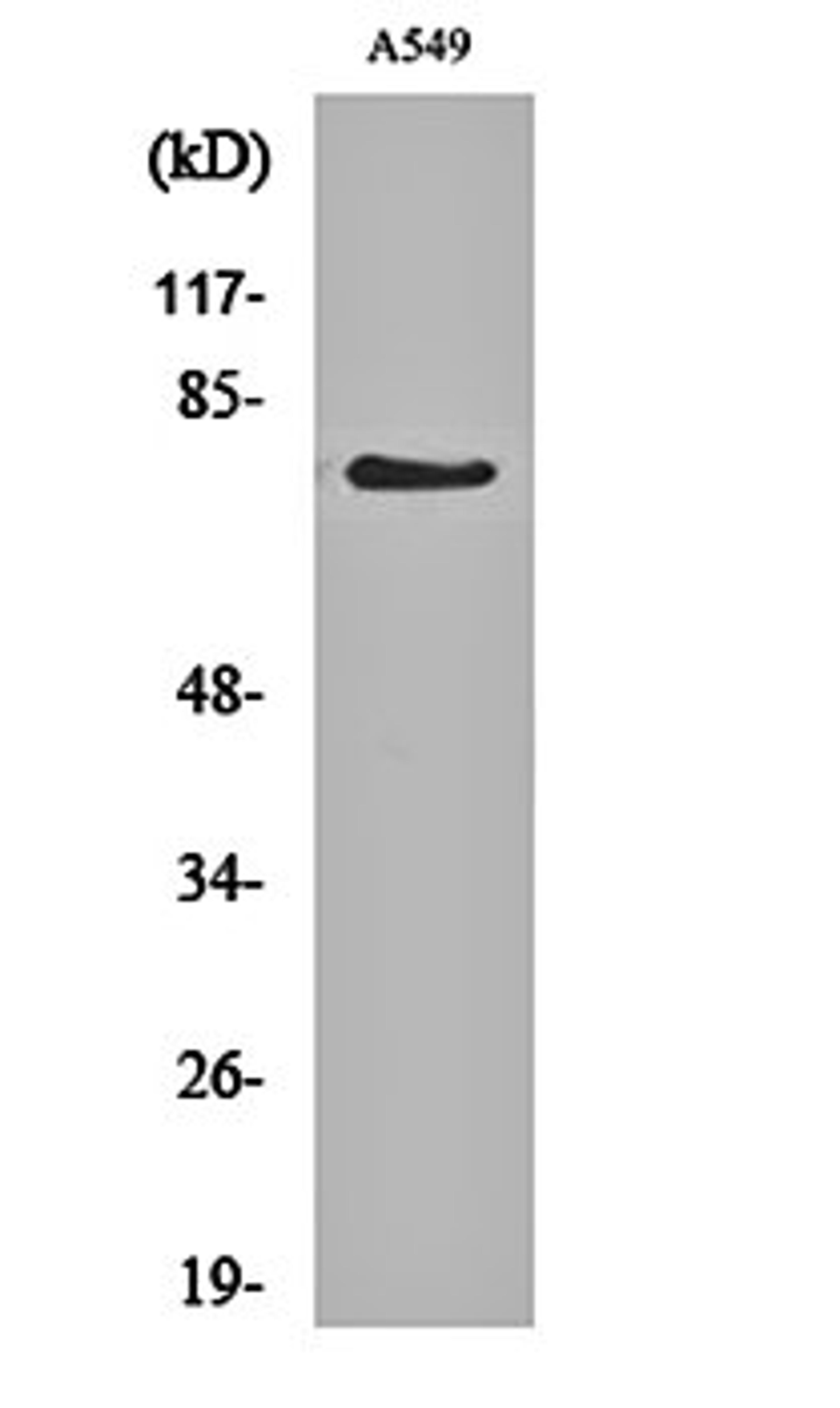 Western blot analysis of A549 cell lysates using GCS- alpha-1 antibody