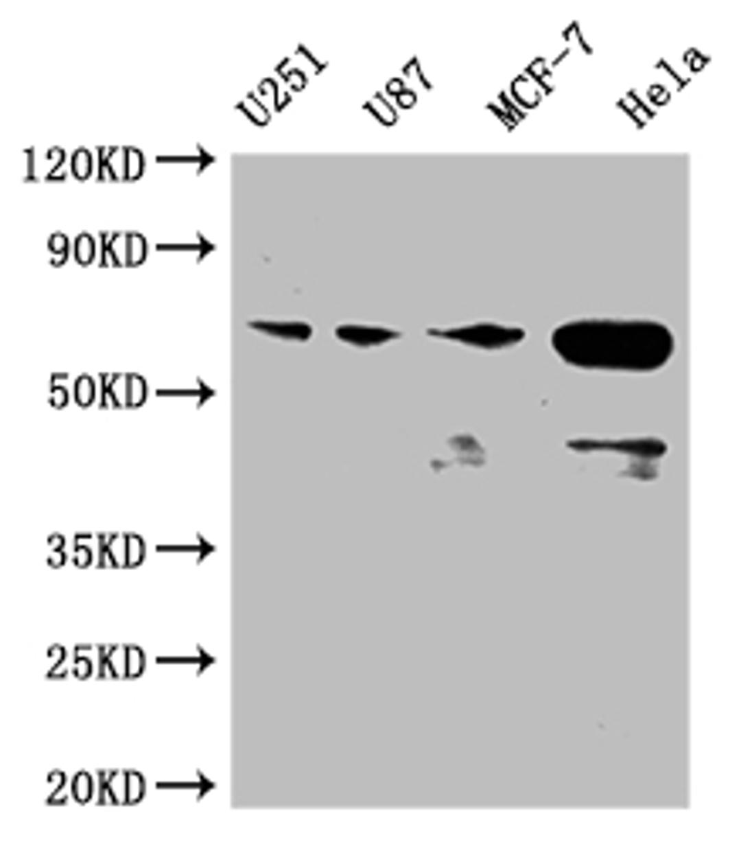 Western Blot. Positive WB detected in: U251 whole cell lysate, U87 whole cell lysate, MCF-7 whole cell lysate, Hela whole cell lysate. All lanes: STK3 antibody at 1:2000. Secondary. Goat polyclonal to rabbit IgG at 1/50000 dilution. Predicted band size: 57, 60 kDa. Observed band size: 50-70 kDa. 