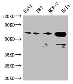 Western Blot. Positive WB detected in: U251 whole cell lysate, U87 whole cell lysate, MCF-7 whole cell lysate, Hela whole cell lysate. All lanes: STK3 antibody at 1:2000. Secondary. Goat polyclonal to rabbit IgG at 1/50000 dilution. Predicted band size: 57, 60 kDa. Observed band size: 50-70 kDa. 