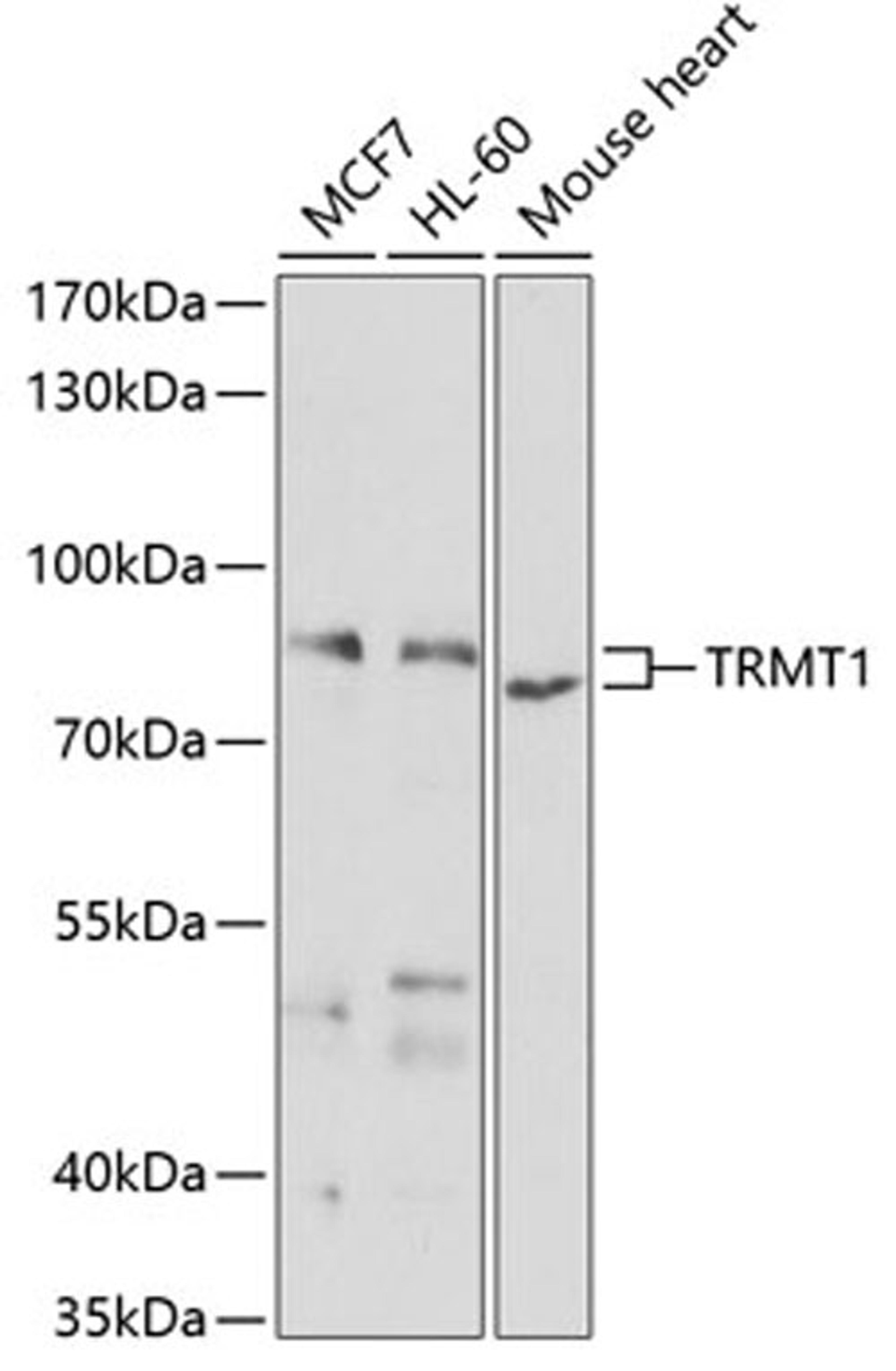 Western blot - TRMT1 antibody (A7116)