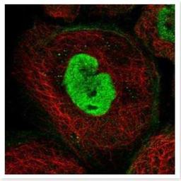 Immunocytochemistry/Immunofluorescence: PRAME Family Member 12 Antibody [NBP2-23613] - PRAME Family Member 12 Antibody Immunofluorescent staining of human cell line A-431 shows positivity in nucleus but not nucleoli & cytoskeleton (actin filaments).