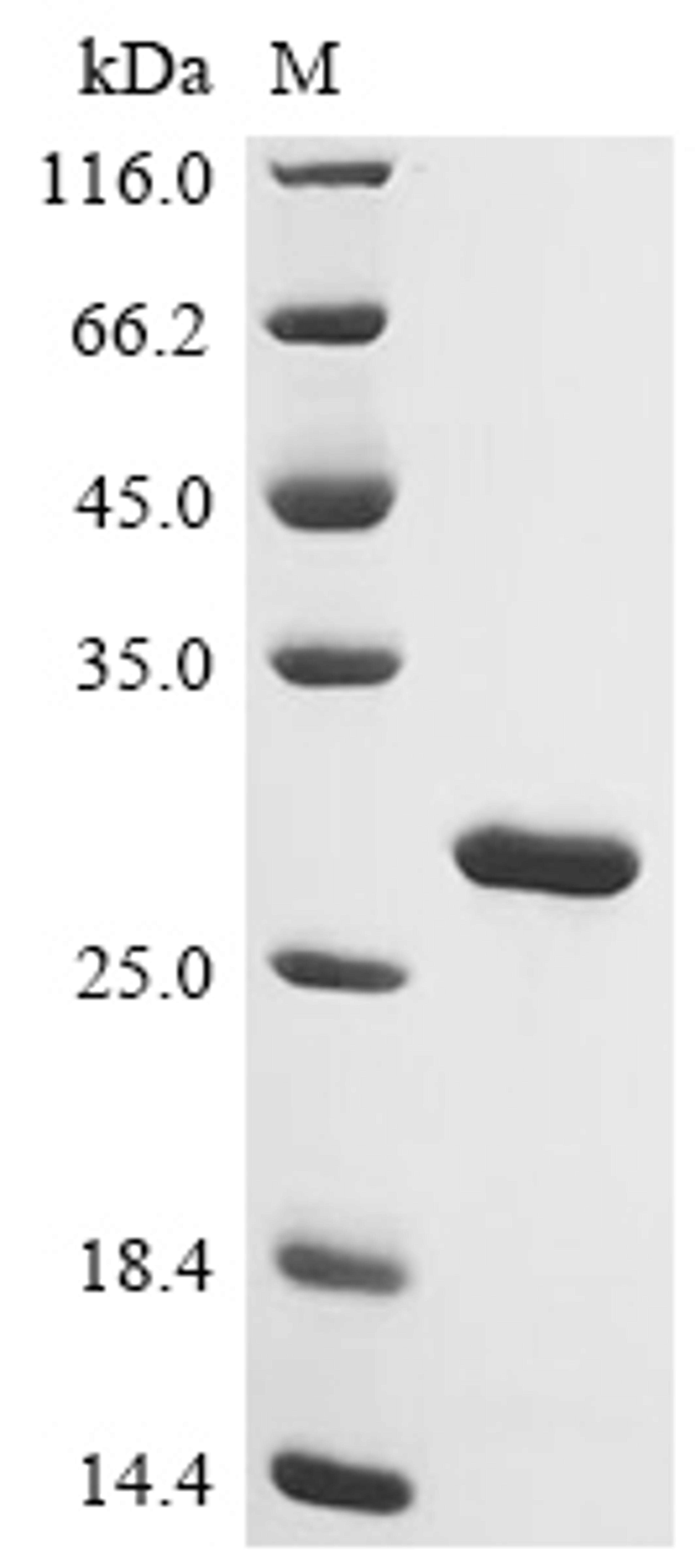 (Tris-Glycine gel) Discontinuous SDS-PAGE (reduced) with 5% enrichment gel and 15% separation gel.
