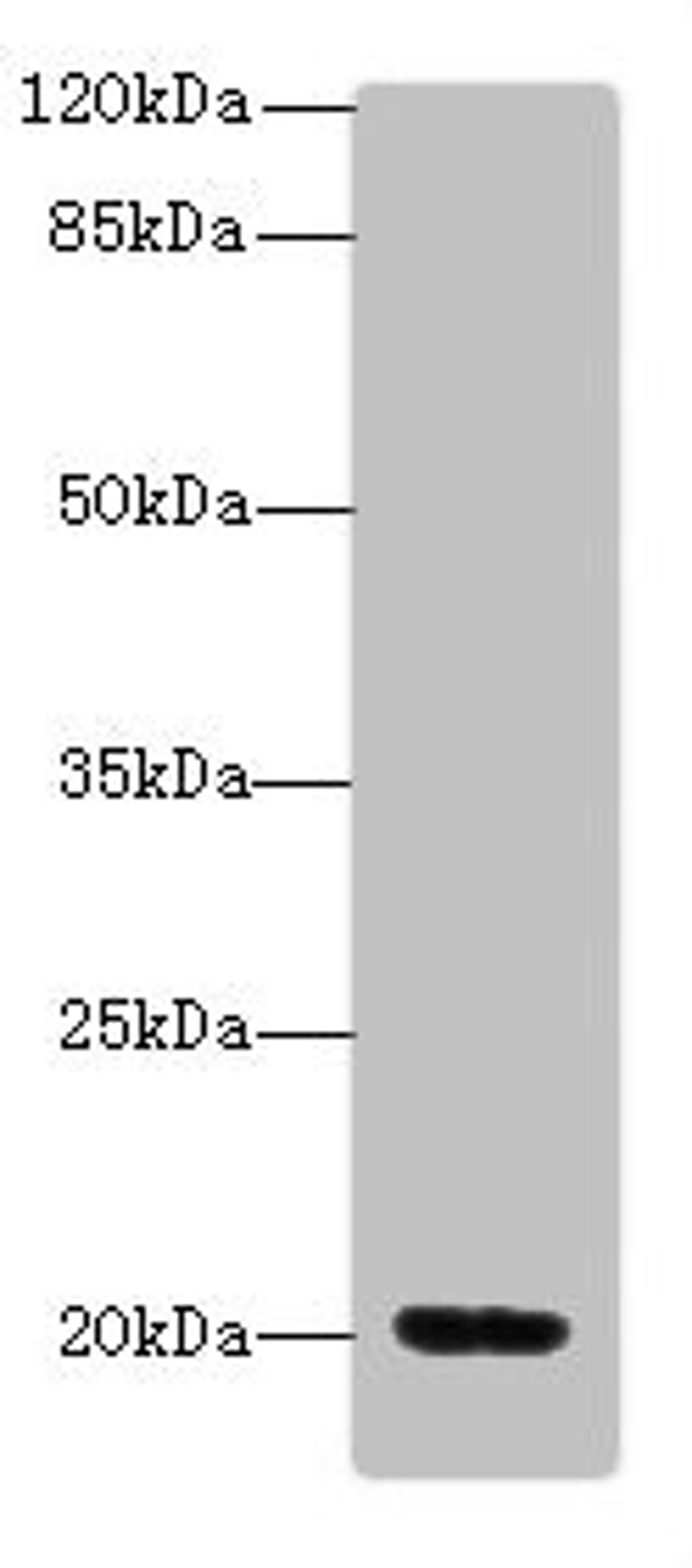 Western blot. All lanes: MSRB2antibody at 5.58ug/ml + Mouse heart tissue. Secondary. Goat polyclonal to rabbit IgG at 1/10000 dilution. Predicted band size: 20 kDa. Observed band size: 20 kDa.