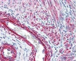 Immunohistochemical staining of variety of tissues including multi-human, multi-brain and multi-cancer slides using Myosin phospho S19 antibody