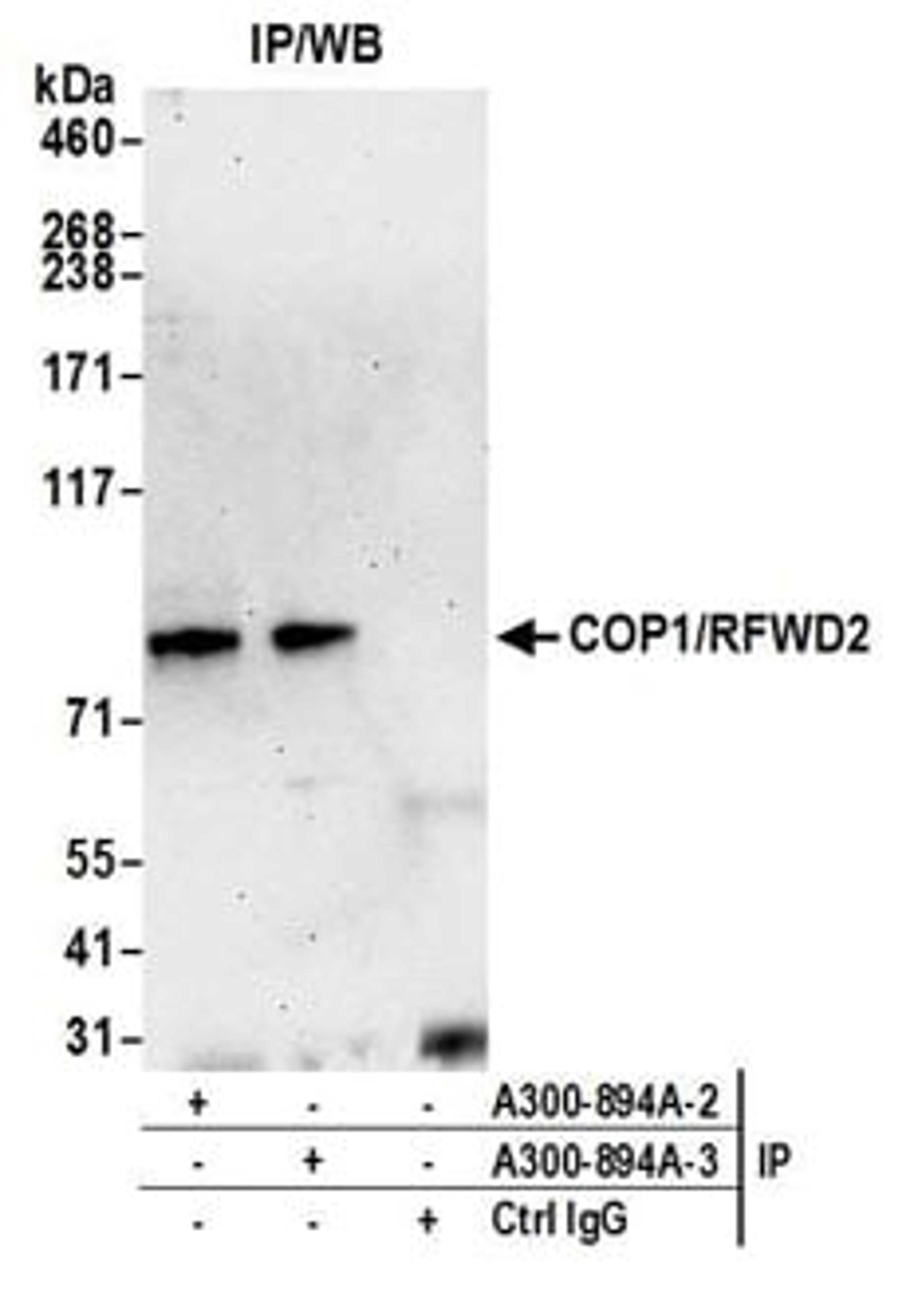 Detection of human COP1/RFWD2 by western blot of immunoprecipitates.