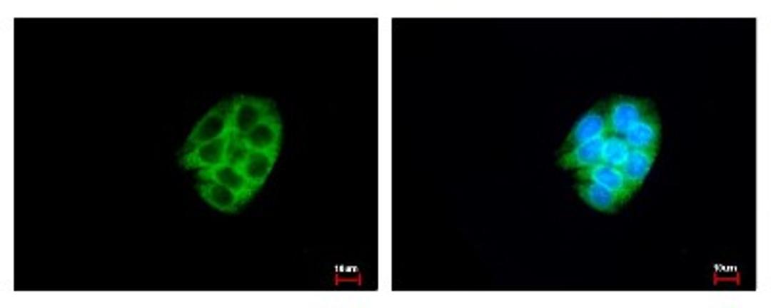 Immunocytochemistry/Immunofluorescence: CES2 Antibody [NBP1-32653] - Sample: HepG2 cells were fixed in iced-cold MeOH for 5 min. Green: CES2 protein stained by CES2 antibody diluted at 1:500. Blue: Hoechst 33342 staining.