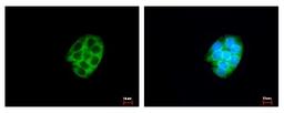 Immunocytochemistry/Immunofluorescence: CES2 Antibody [NBP1-32653] - Sample: HepG2 cells were fixed in iced-cold MeOH for 5 min. Green: CES2 protein stained by CES2 antibody diluted at 1:500. Blue: Hoechst 33342 staining.