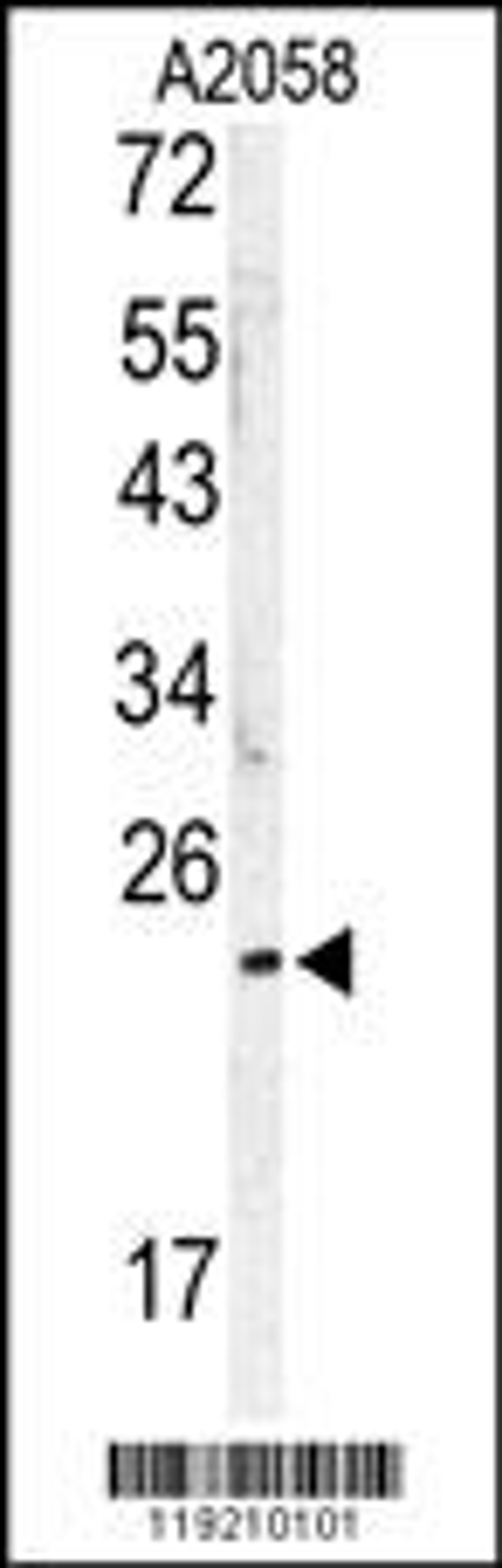 Western blot analysis of MOBKL1B antibody in A2058 cell line lysates (35ug/lane)