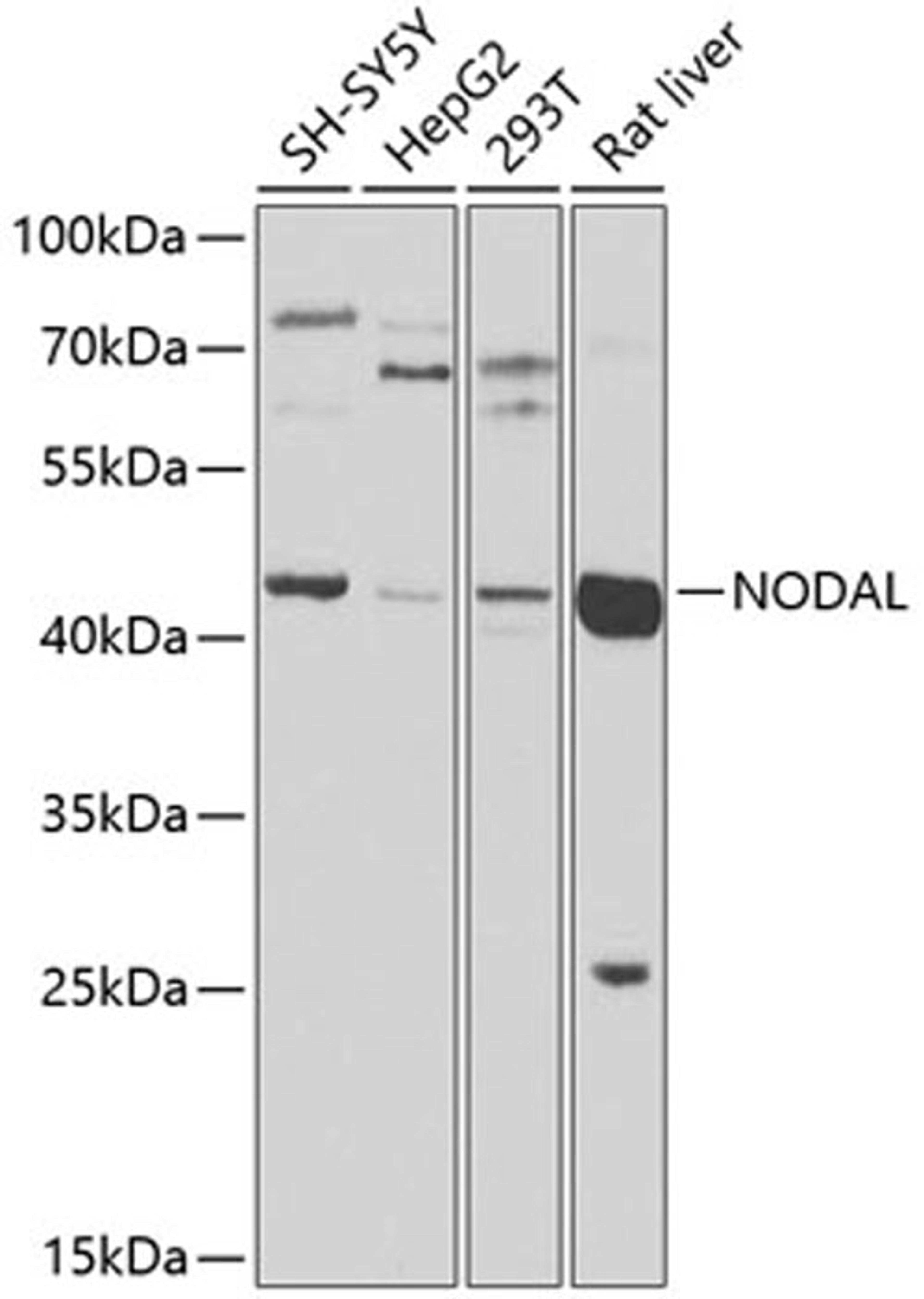 Western blot - NODAL antibody (A9902)