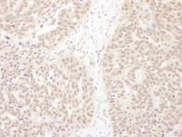 Detection of human WDR5 by immunohistochemistry.