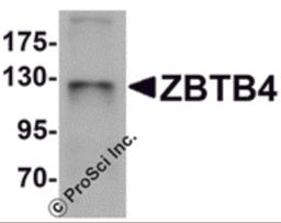 Western blot analysis of ZBTB4 in SK-N-SH cell lysate with ZBTB4 antibody at 1 μg/mL.