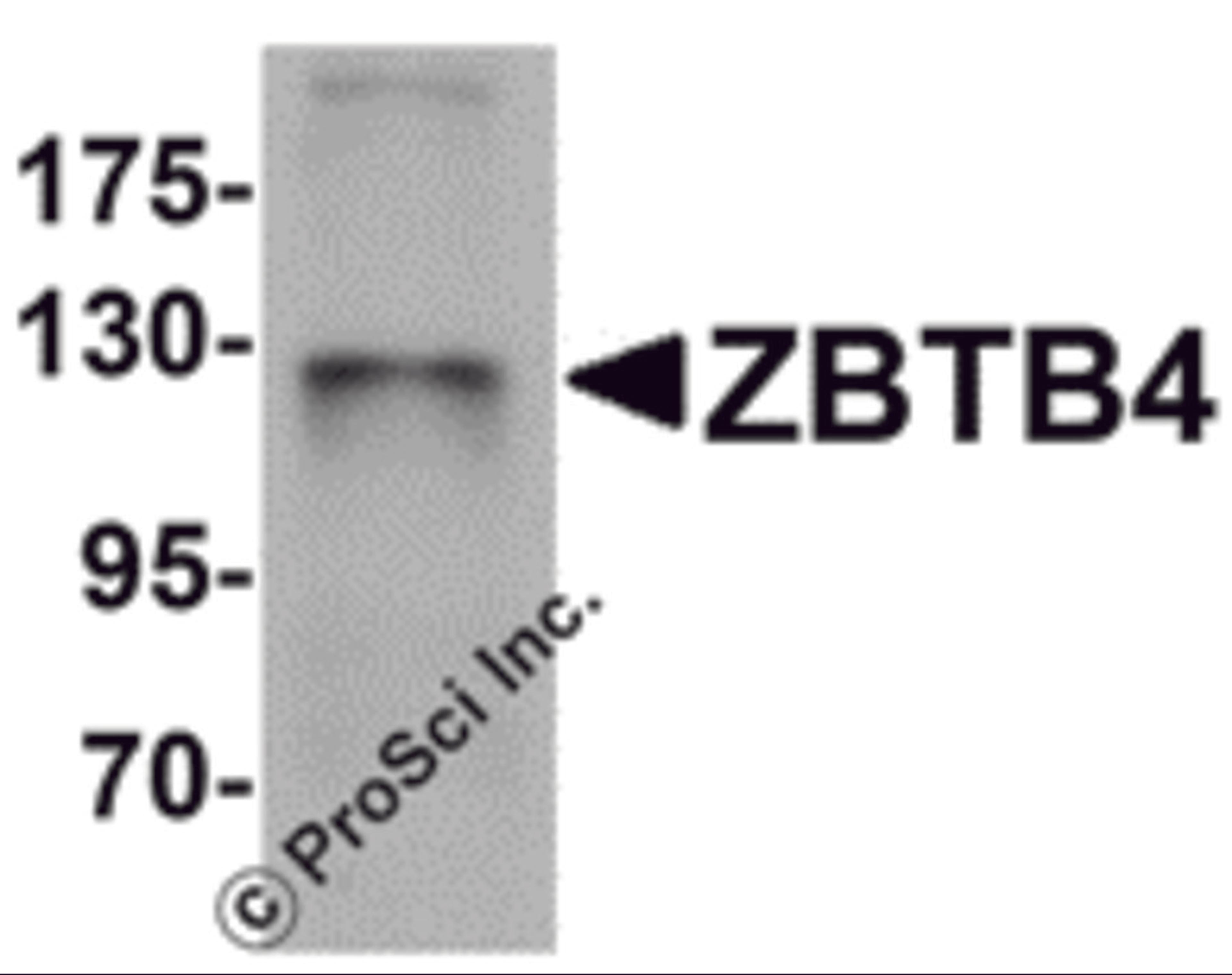 Western blot analysis of ZBTB4 in SK-N-SH cell lysate with ZBTB4 antibody at 1 μg/mL.