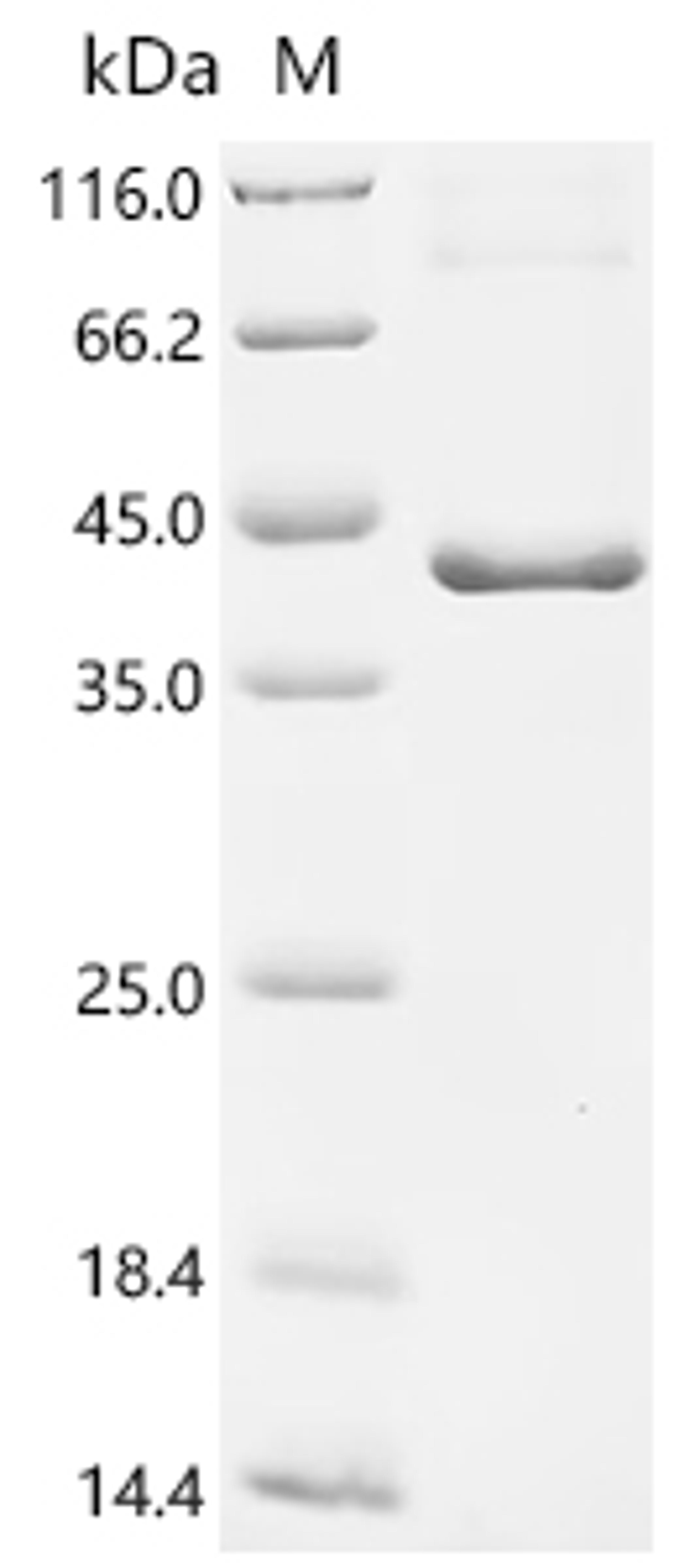 (Tris-Glycine gel) Discontinuous SDS-PAGE (reduced) with 5% enrichment gel and 15% separation gel.