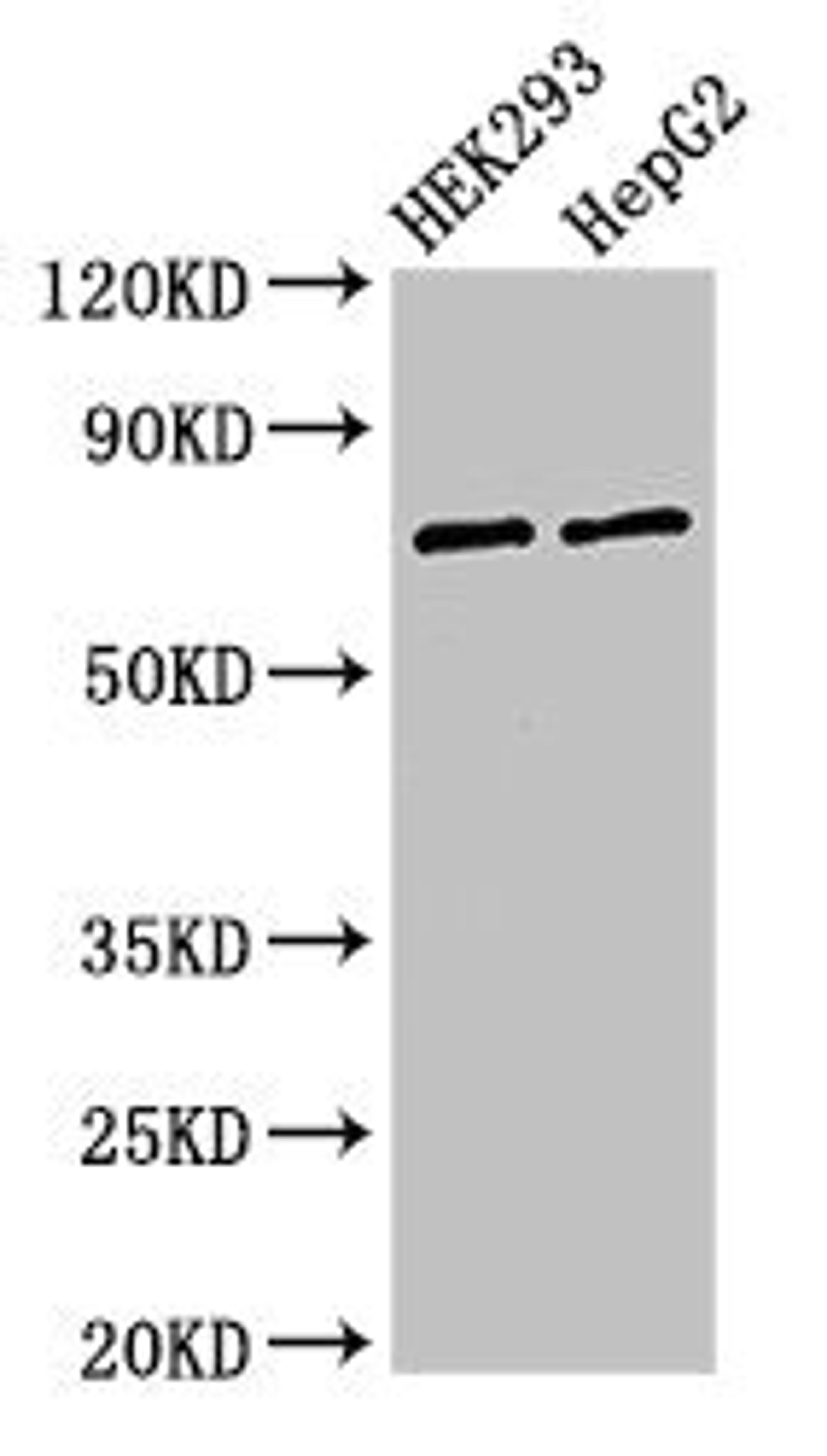 Western Blot. Positive WB detected in: HEK293 whole cell lysate, HepG2 whole cell lysate. All lanes: GTPBP4 antibody at 3µg/ml. Secondary. Goat polyclonal to rabbit IgG at 1/50000 dilution. Predicted band size: 74, 69, 61 kDa. Observed band size: 74 kDa