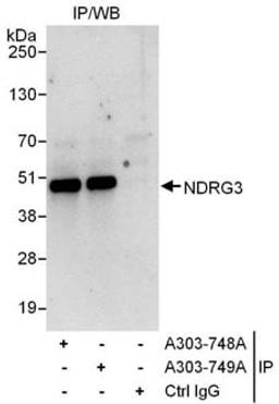 Detection of human NDRG3 by western blot of immunoprecipitates.