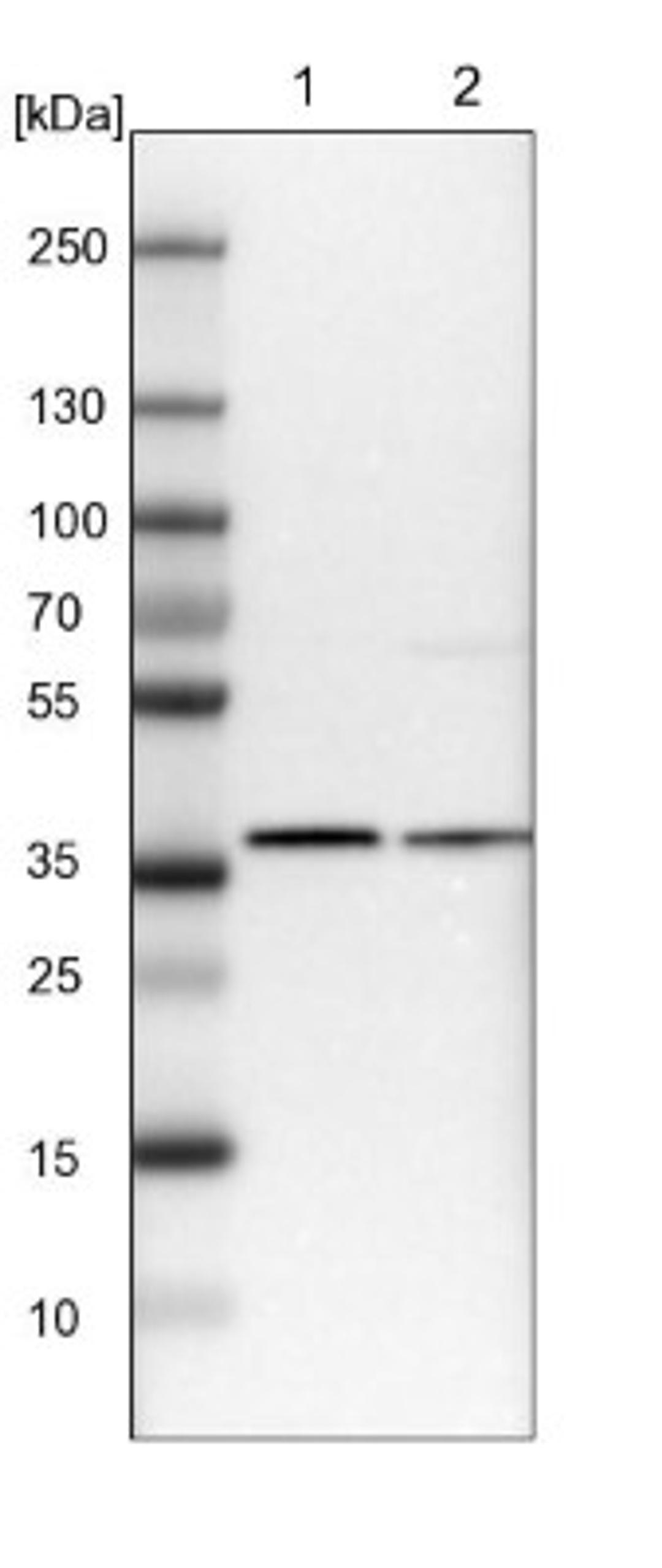 Western Blot: Ymer Antibody [NBP1-88265] - Lane 1: NIH-3T3 cell lysate (Mouse embryonic fibroblast cells)<br/>Lane 2: NBT-II cell lysate (Rat Wistar bladder tumour cells)