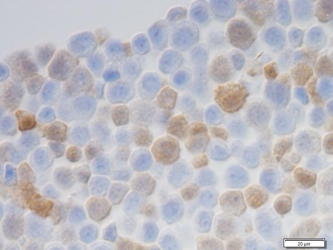 Immunohistochemical analysis of mouse mammary tumor cell line using mCherry goat antibody