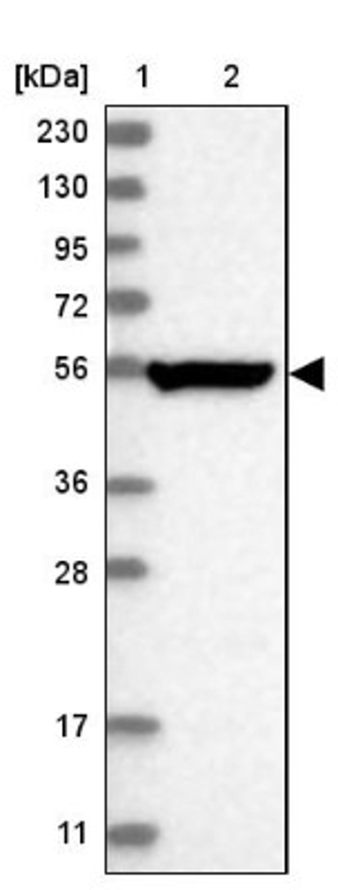 Western Blot: TSPYL6 Antibody [NBP1-85917] - Lane 1: Marker [kDa] 230, 130, 95, 72, 56, 36, 28, 17, 11<br/>Lane 2: Human cell line RT-4