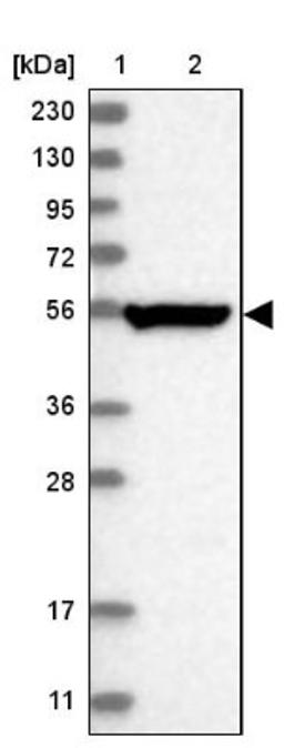 Western Blot: TSPYL6 Antibody [NBP1-85917] - Lane 1: Marker [kDa] 230, 130, 95, 72, 56, 36, 28, 17, 11<br/>Lane 2: Human cell line RT-4