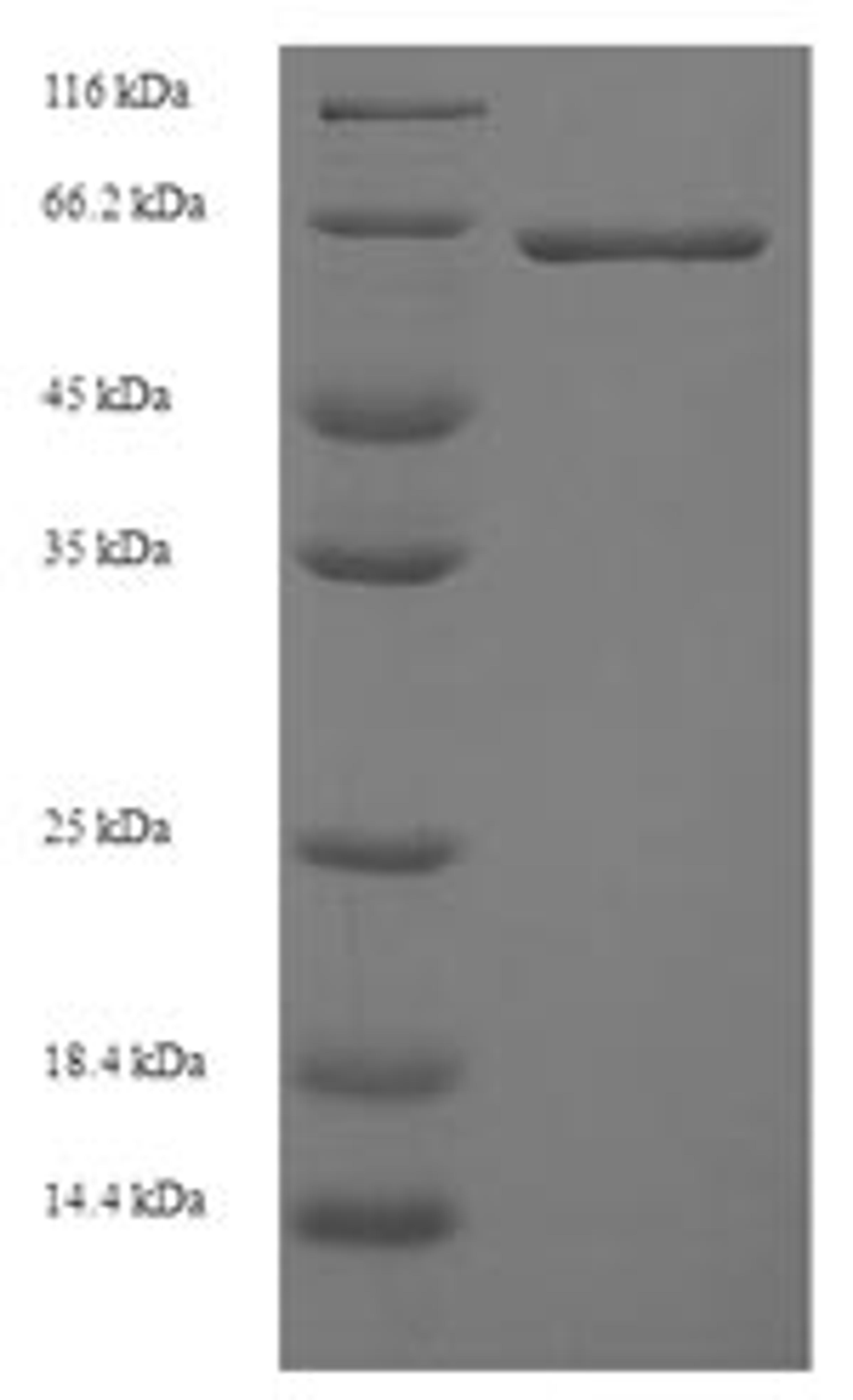 (Tris-Glycine gel) Discontinuous SDS-PAGE (reduced) with 5% enrichment gel and 15% separation gel.