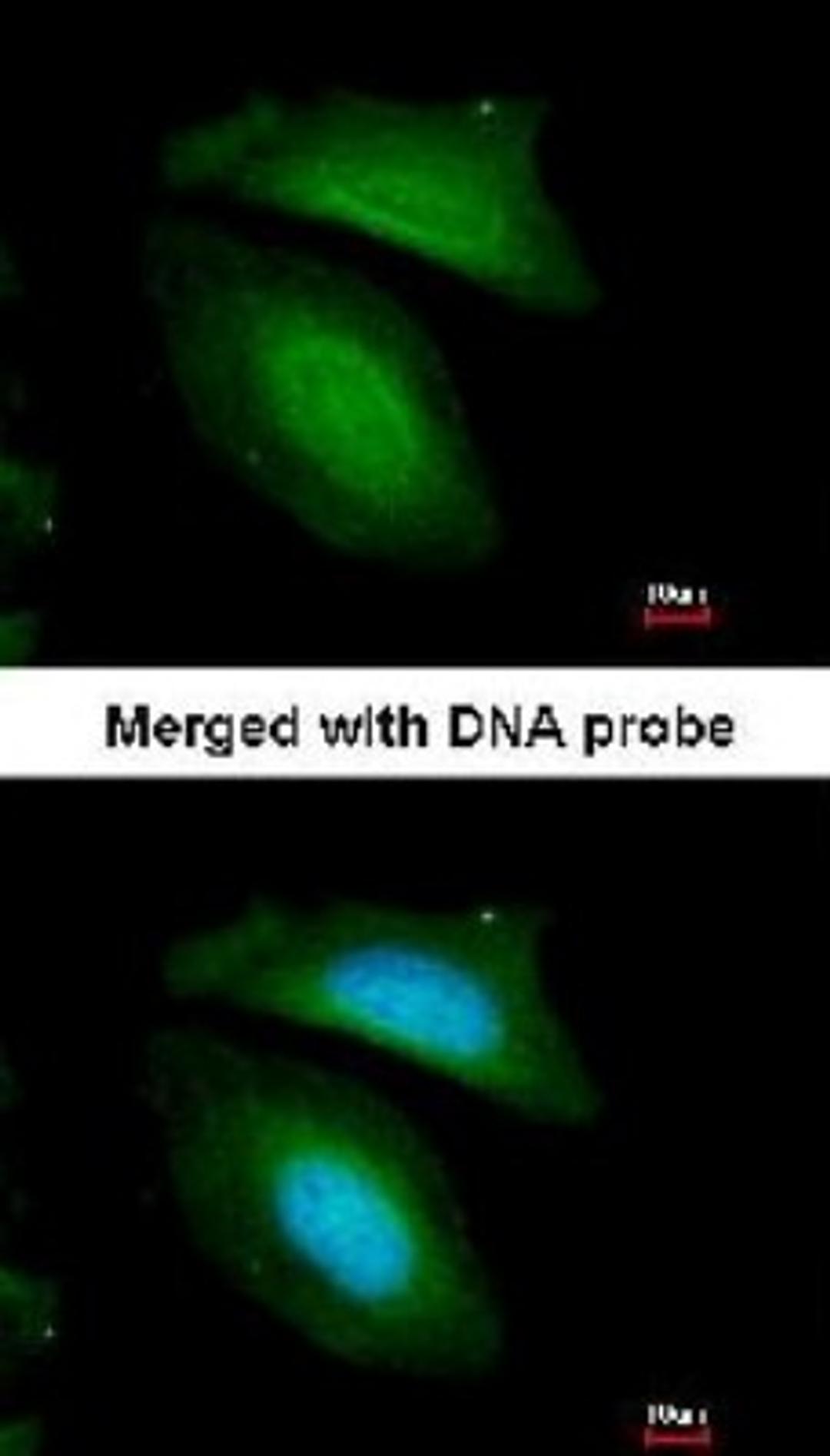 Immunocytochemistry/Immunofluorescence: BZW2 Antibody [NBP1-32519] - analysis of HeLa, using BZW2 antibody at 1:200 dilution.