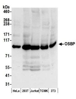 Detection of human and mouse OSBP by western blot.