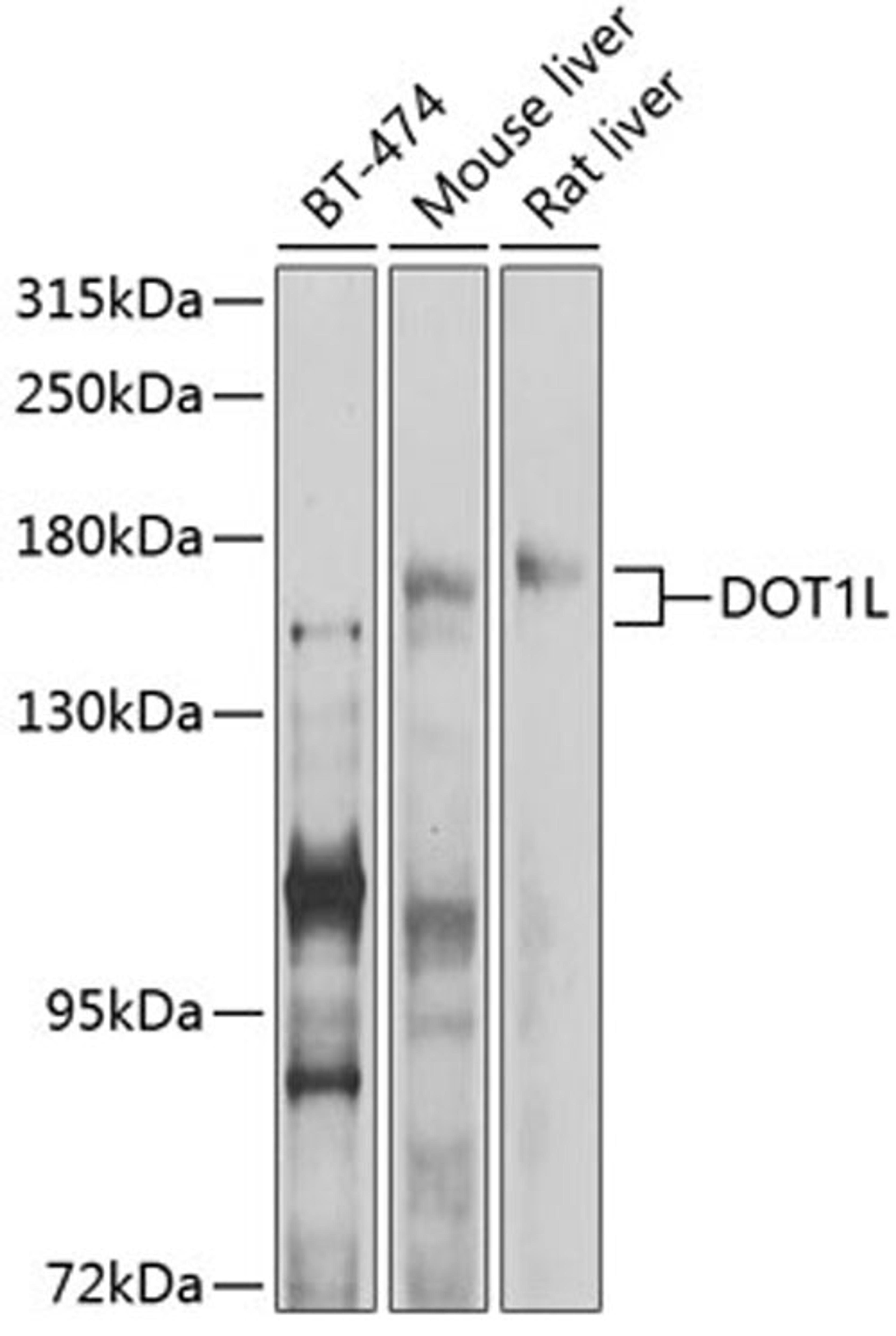 Western blot - DOT1L antibody (A11286)