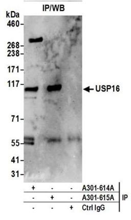 Detection of human USP16 by western blot of immunoprecipitates.