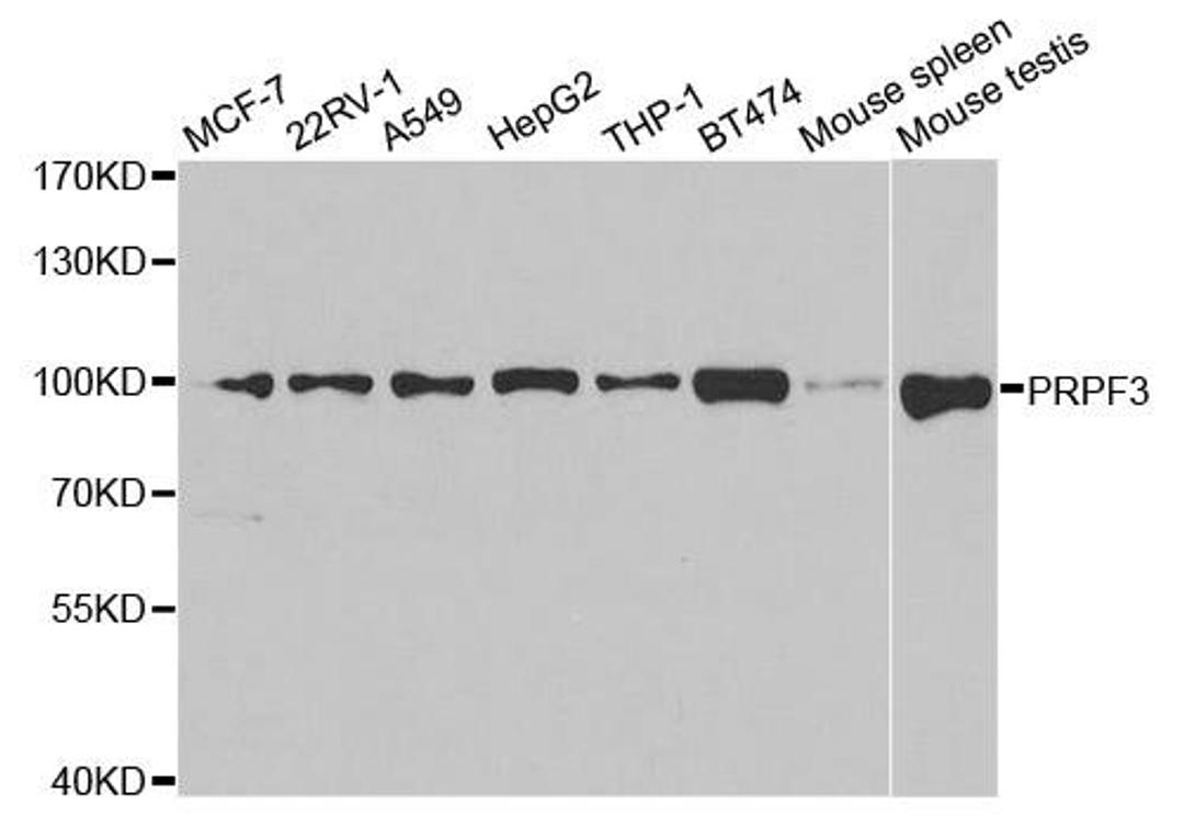 Western blot analysis of extracts of various cell lines using PRPF3 antibody