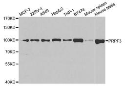 Western blot analysis of extracts of various cell lines using PRPF3 antibody