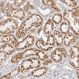 Immunohistochemistry-Paraffin: Elp3 Antibody [NBP1-84625] - Staining of human kidney shows strong cytoplasmic positivity in tubular cells.