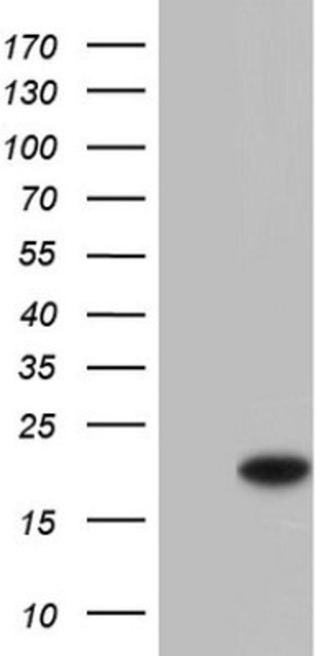 Western Blot: SNX12 Antibody (3A4) [NBP2-45895] - Analysis of HEK293T cells were transfected with the pCMV6-ENTRY control (Left lane) or pCMV6-ENTRY SNX12.