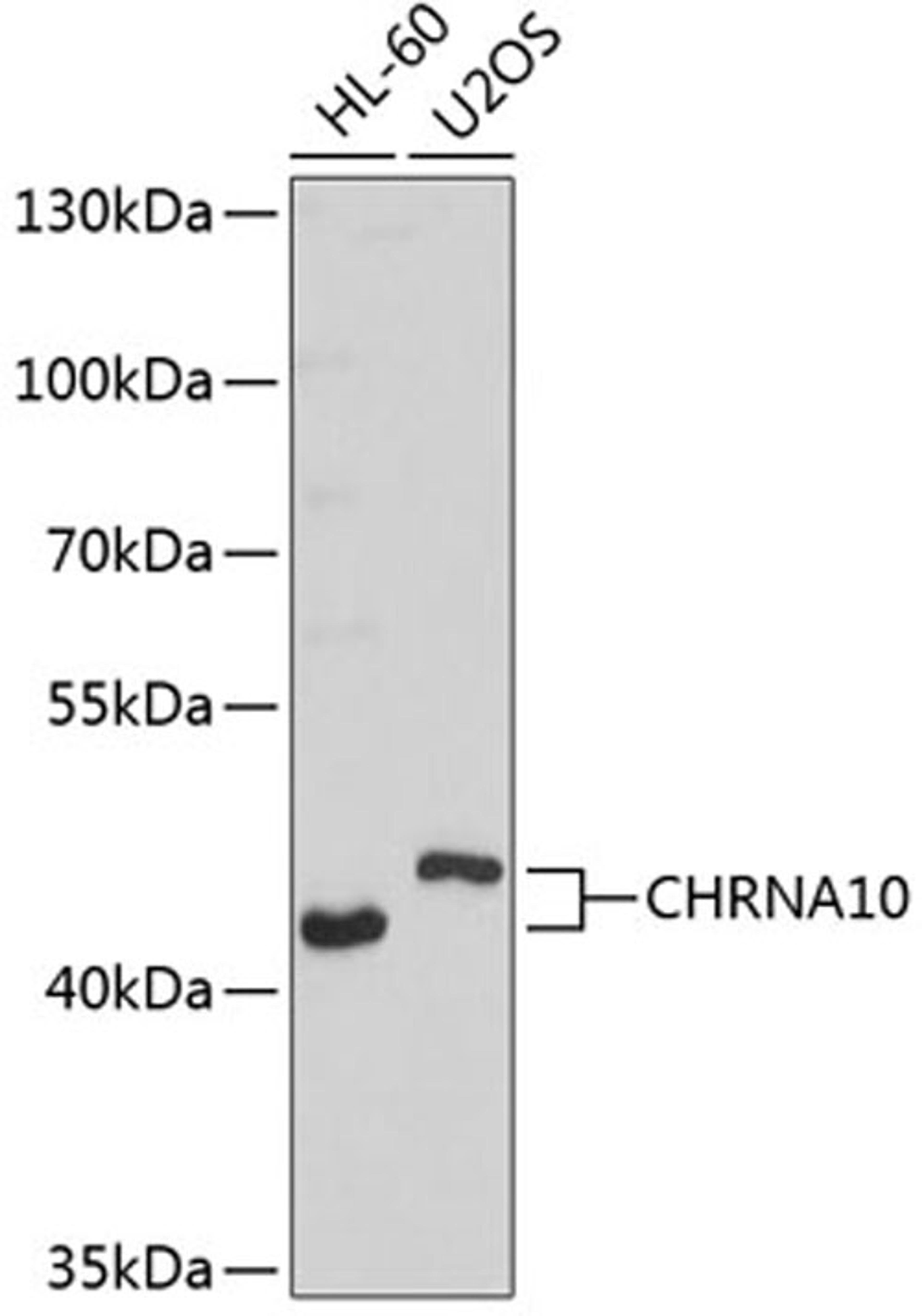 Western blot - CHRNA10 antibody (A3042)
