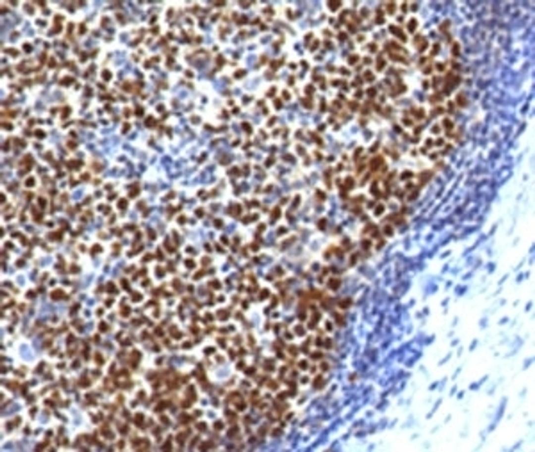 IHC testing of FFPE human tonsil with Bcl6 antibody (clone ARBC6-1).