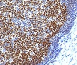 IHC testing of FFPE human tonsil with Bcl6 antibody (clone ARBC6-1).