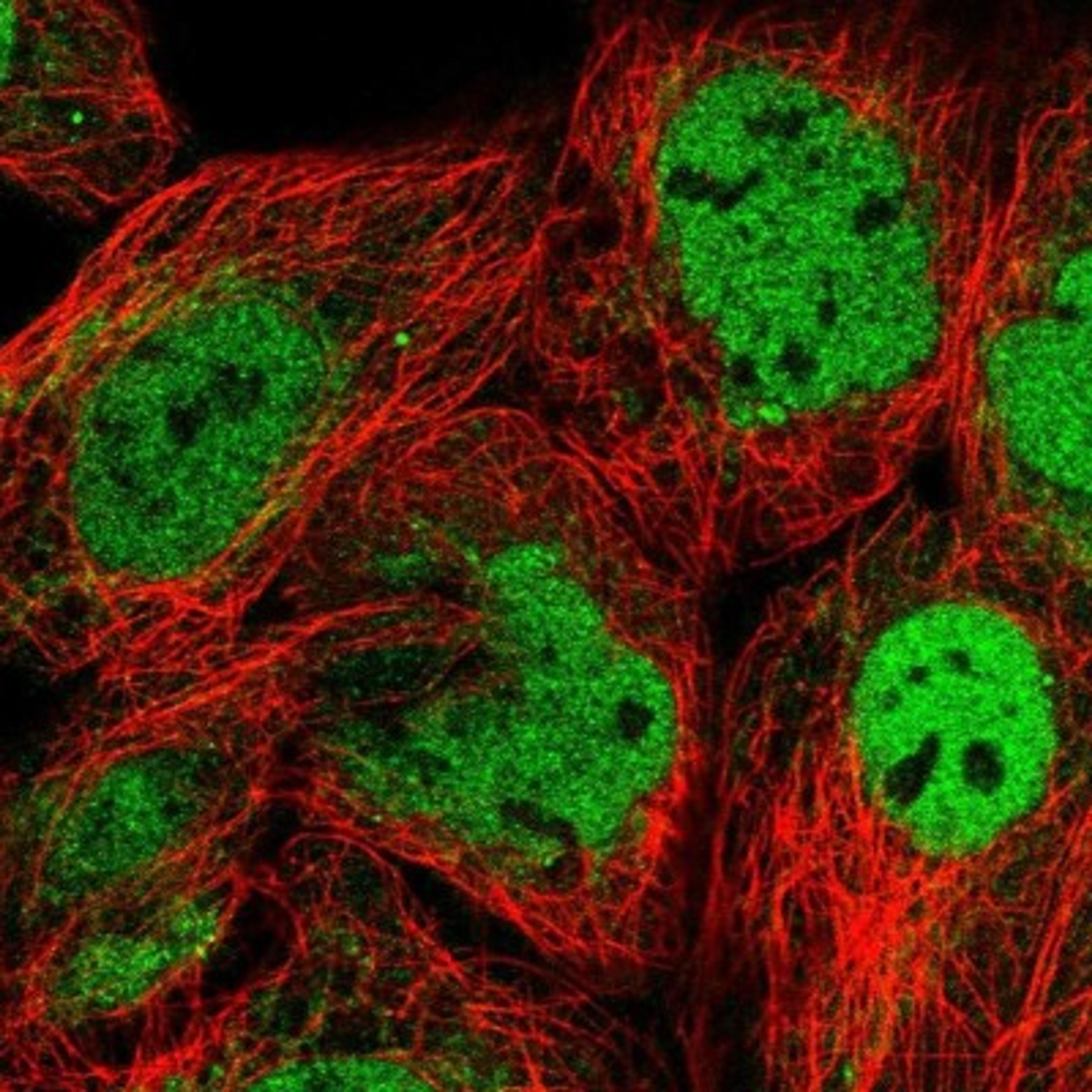 Immunofluorescence: CHTF8 Antibody [NBP2-30490] - Immunofluorescent staining of human cell line A-431 shows positivity in nucleus but not nucleoli.