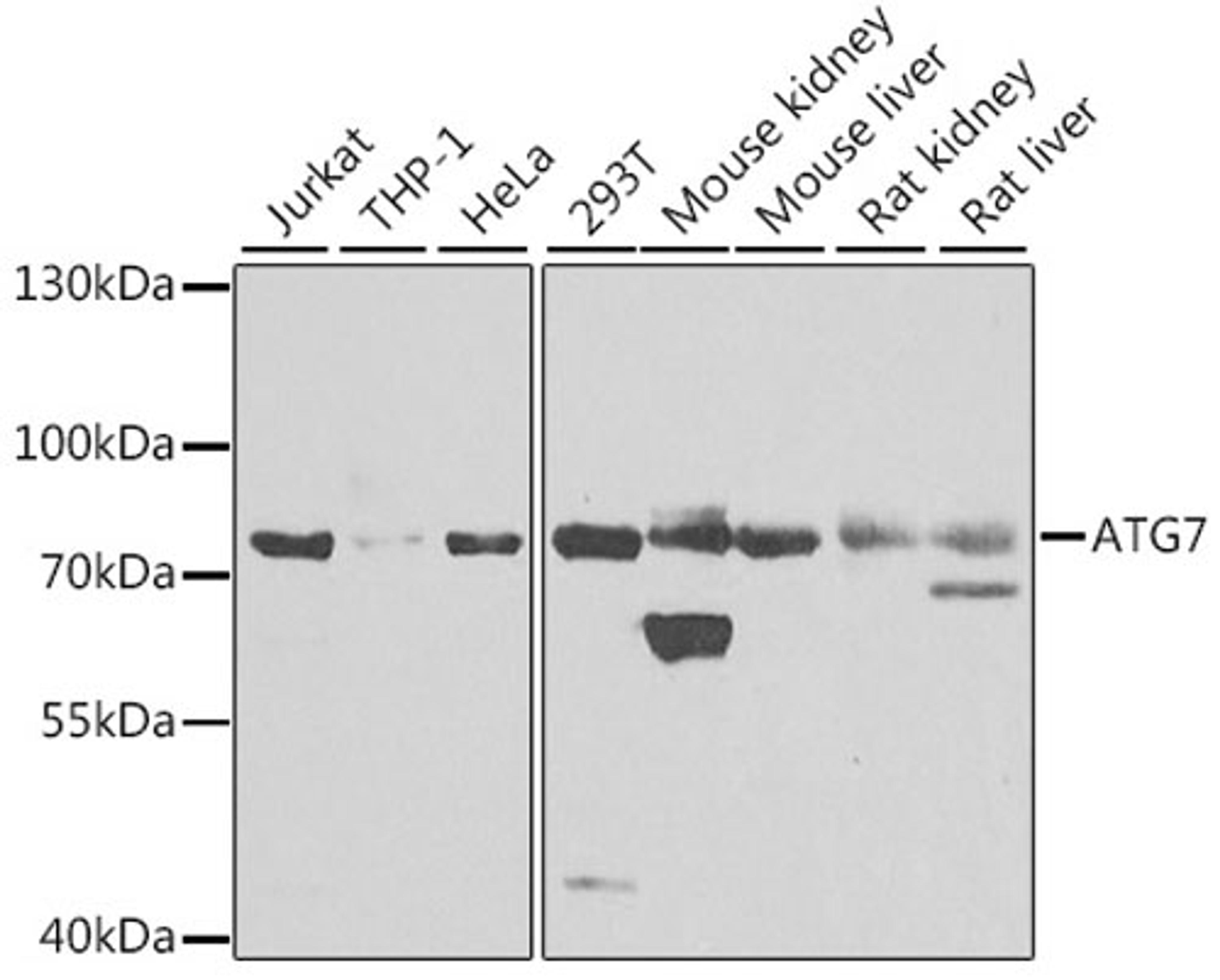 Western blot - ATG7 antibody (A0691)