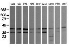 Western Blot: JNK2 Antibody (1A1) [NBP2-45815] - Analysis of extracts (35ug) from 9 different cell lines (HepG2: human; HeLa: human; SVT2: mouse; A549: human; COS7: monkey; Jurkat: human; MDCK: canine; PC12: rat; MCF7: human).