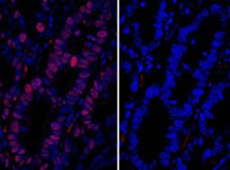 Detection of human MCM3 by immunofluorescence.